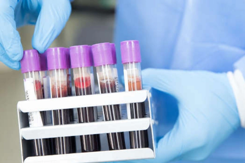 В Британии протестируют метод диагностики рака простаты с ИИ