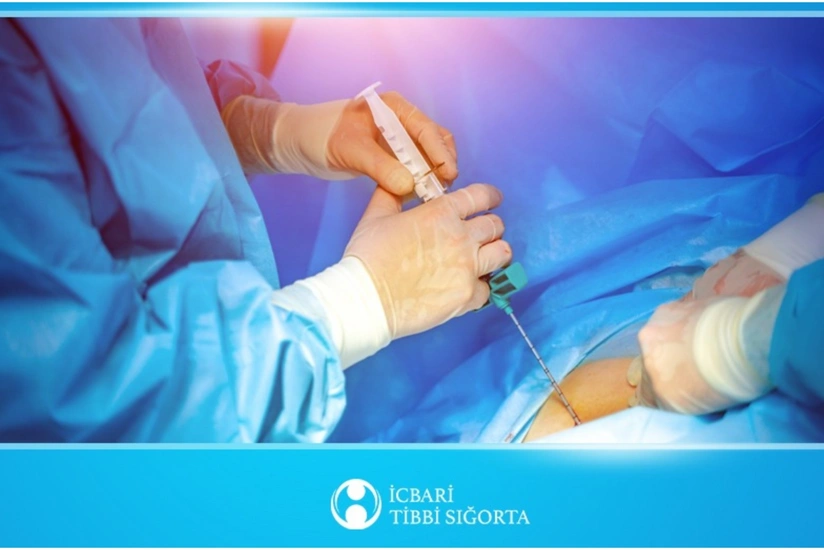 Son bir ildə icbari tibbi sığorta hesabına 20-dən çox sümük iliyi transplantasiyası icra olunub