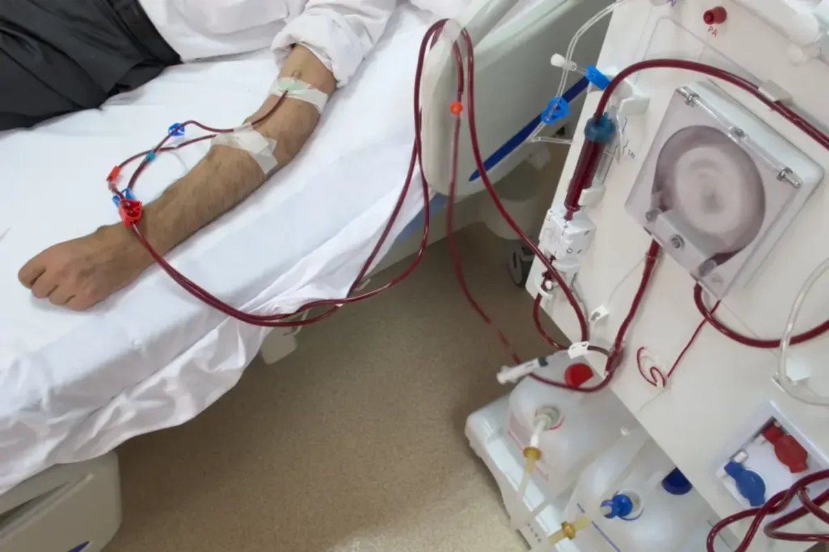 Gələn il Azərbaycanda yeni hemodializ şöbələri yaradılacaq