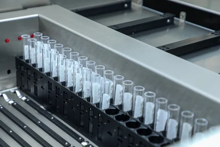 Mərkəzi Neftçilər Xəstəxanasında yeni autoimmun laboratoriyası istifadəyə verilib