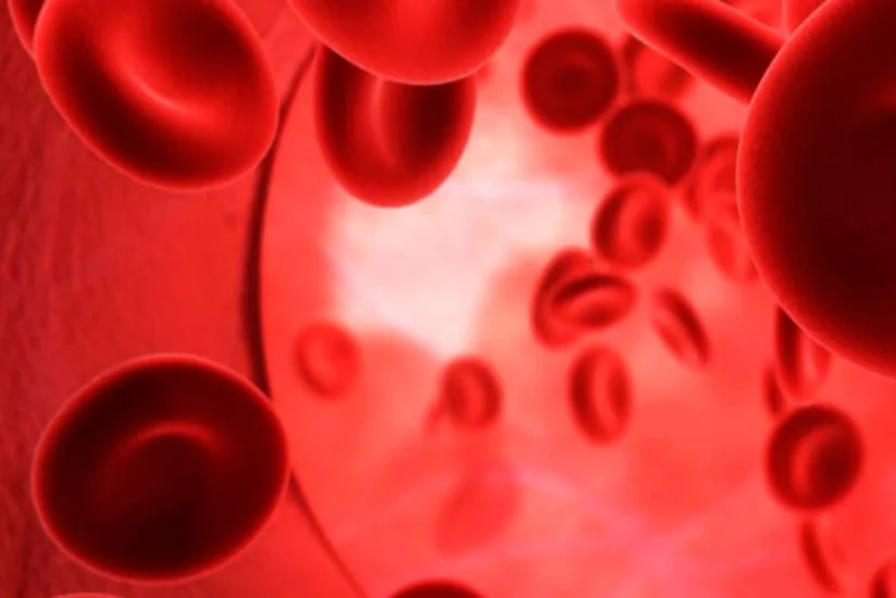 Number of newborns diagnosed with thalassemia declines in Azerbaijan