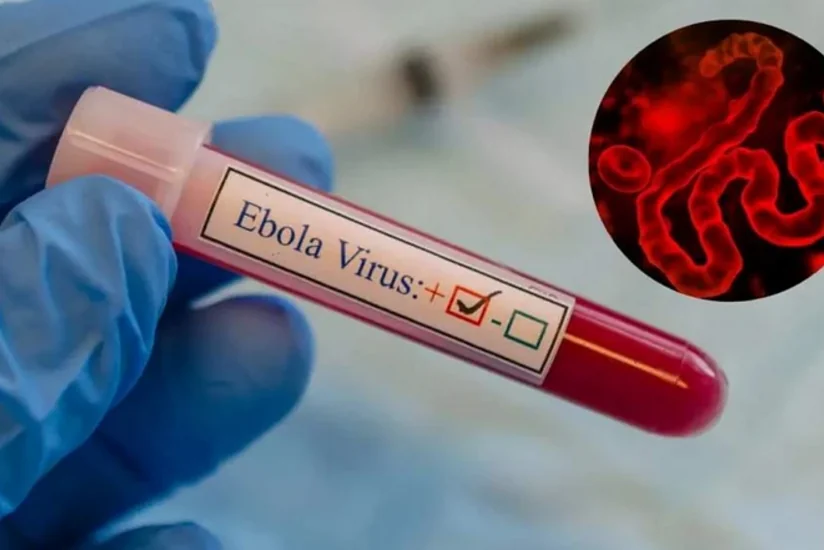 ÜST Ebolanın yeni ştammına qarşı peyvəndin hazırlanmasını sürətləndirir