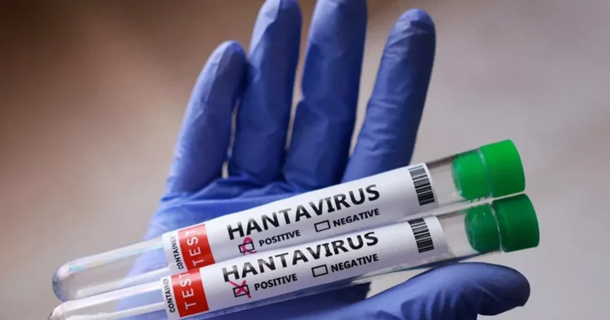 Three patients die of hantavirus in Venezuela
