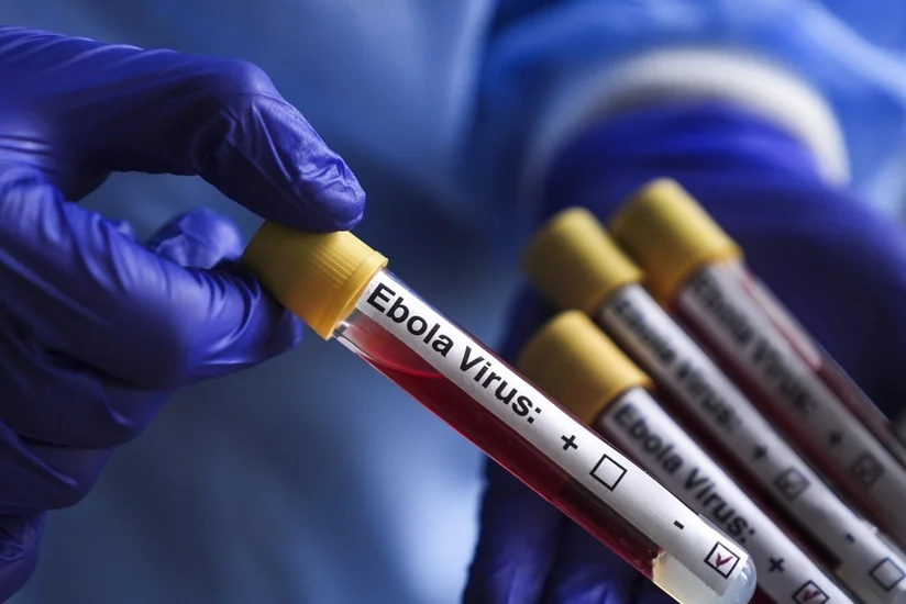 ÜST: Konqoda Ebola epidemiyası yayılmaqda davam edir