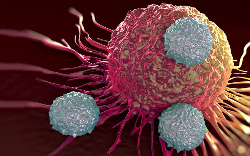 What are main symptoms of bowel cancer?