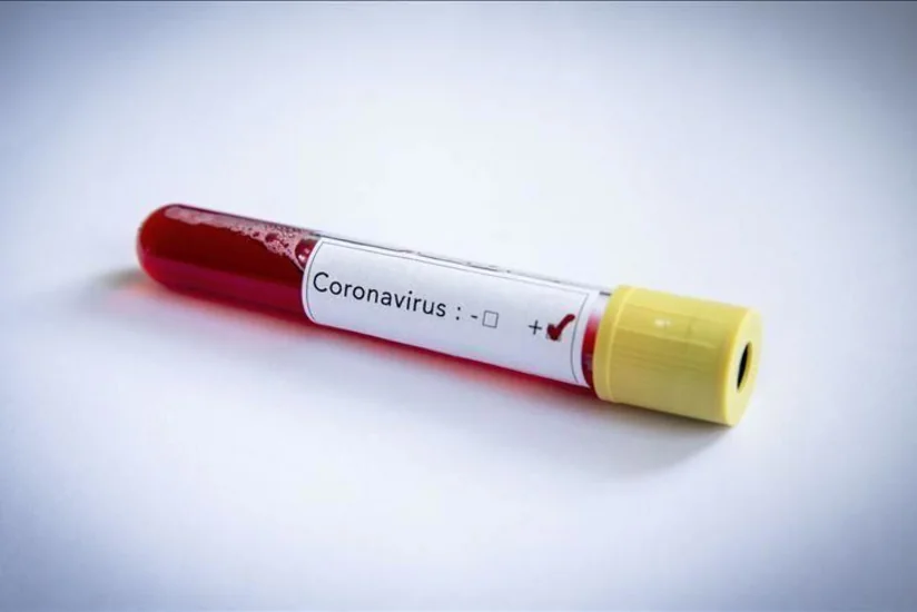 В Формуле-1 выявлено восемь случаев заражения коронавирусом за неделю