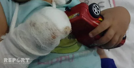 В Сумгайыте мясорубка разрубила пальцы ребенка - ФОТО