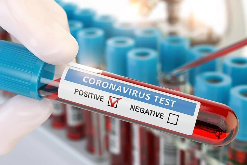 La Liqa klubunun iki üzvündə koronavirus aşkarlandı
