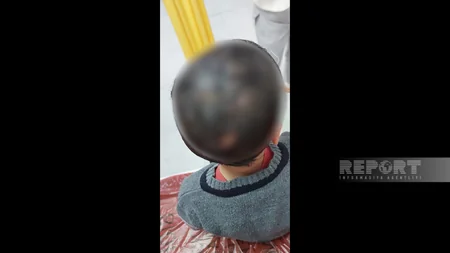 Masazırda azyaşlı uşaqlar itlərin hücumuna məruz qalıblar, vəziyyətləri ağırdır