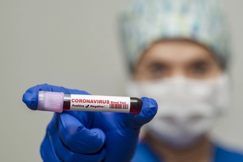 Pakistanda koronavirusa yoluxanların sayı 120 minə çatır