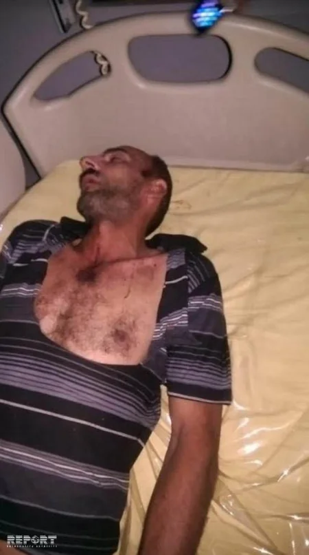Bakıda dava zamanı 3 nəfər yaralanıb, təcili yardımın həkimi girov götürülüb - YENİLƏNİB