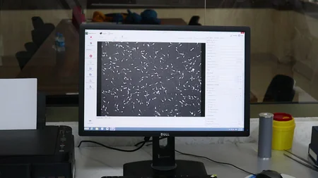 Azərbaycanda ilk dəfə düyələrə embrion transfer edilib