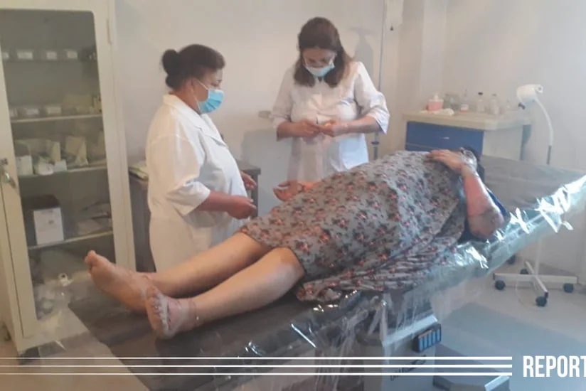 Kürdəmir sakini ehtiyatsızlıqdan özünü yandırıb - FOTO