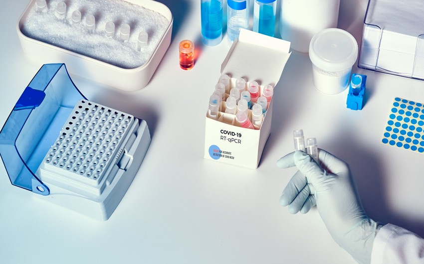 Koronavirus testinin nəticəsinin səhv olmasının səbəbi açıqlandı