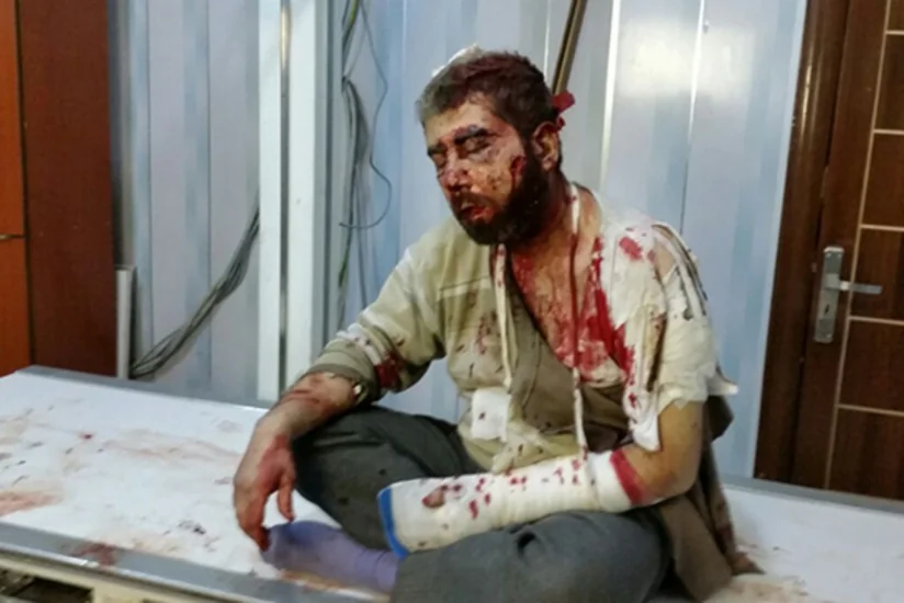 Hələbdən mülki insanları daşıyan avtobus atəşə tutulub, ölən və yaralananlar var