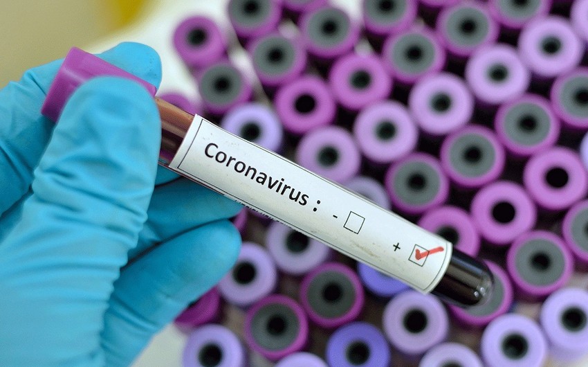 Gürcüstanda koronavirusa yoluxan azərbaycanlının vəziyyəti açıqlandı