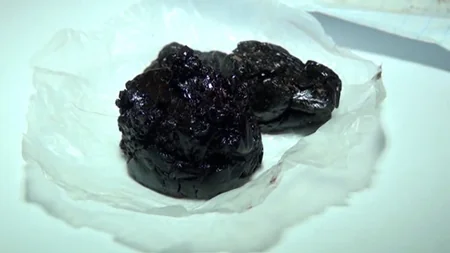 Bakıda tiryəkxana aşkar edilib, 5 nəfər saxlanılıb