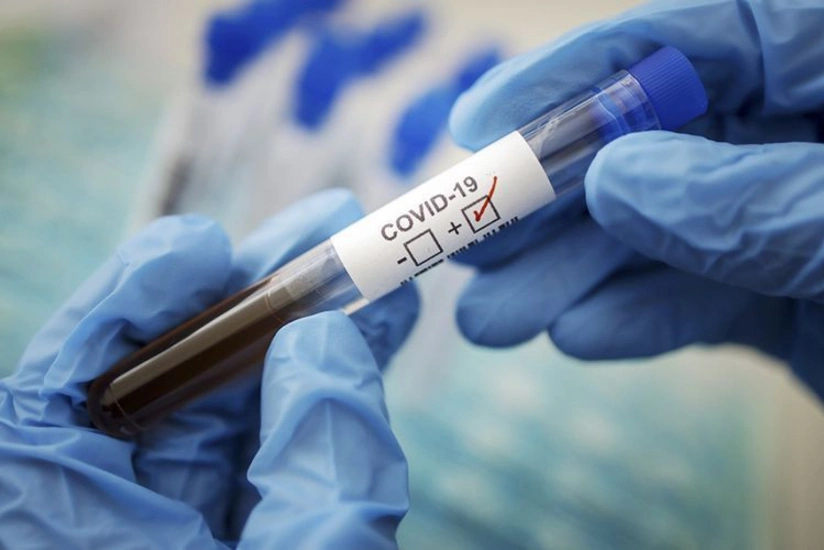 Gürcüstanda koronavirusa yoluxanların sayı 746-ya çatdı