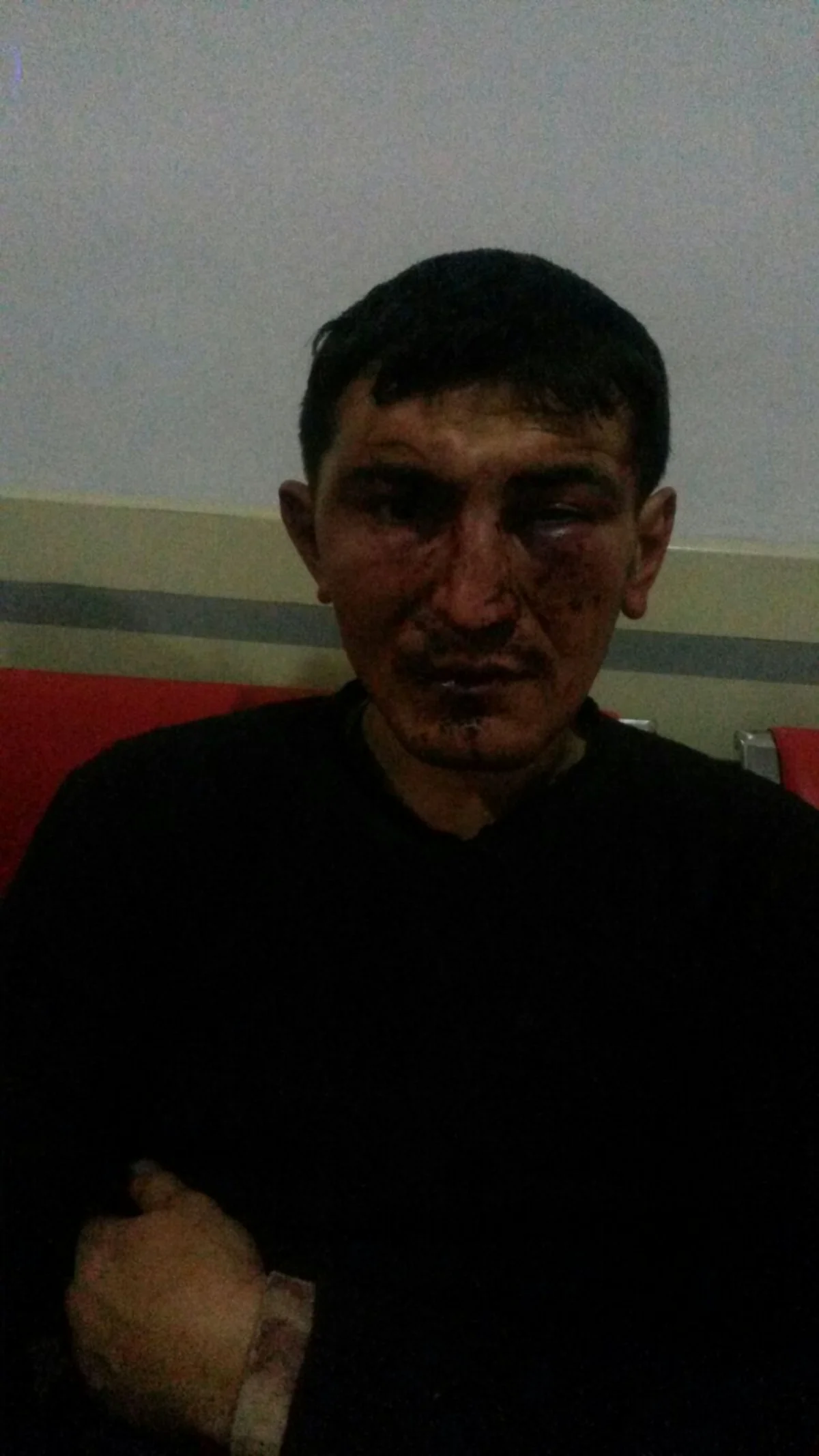 Xudat şəhər sakini öz qaynı tərəfindən döyülüb - FOTO