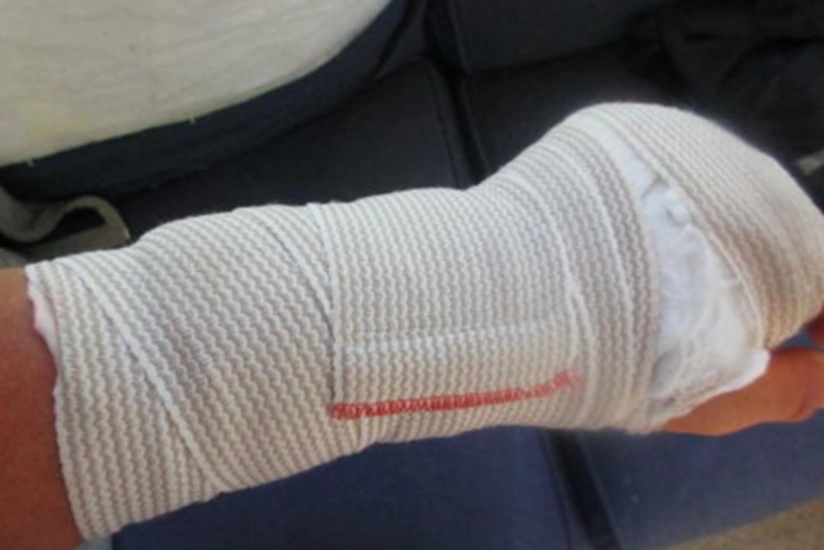 Bakıda döyülən gənc qızın əli sınıb