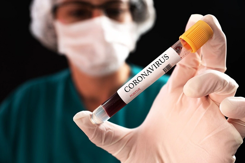 Azerbaijan confirms 65 new COVID-19 cases, vaccinates 480 people in one day