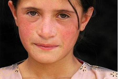 Scientists study Hunza turks never catch cancer