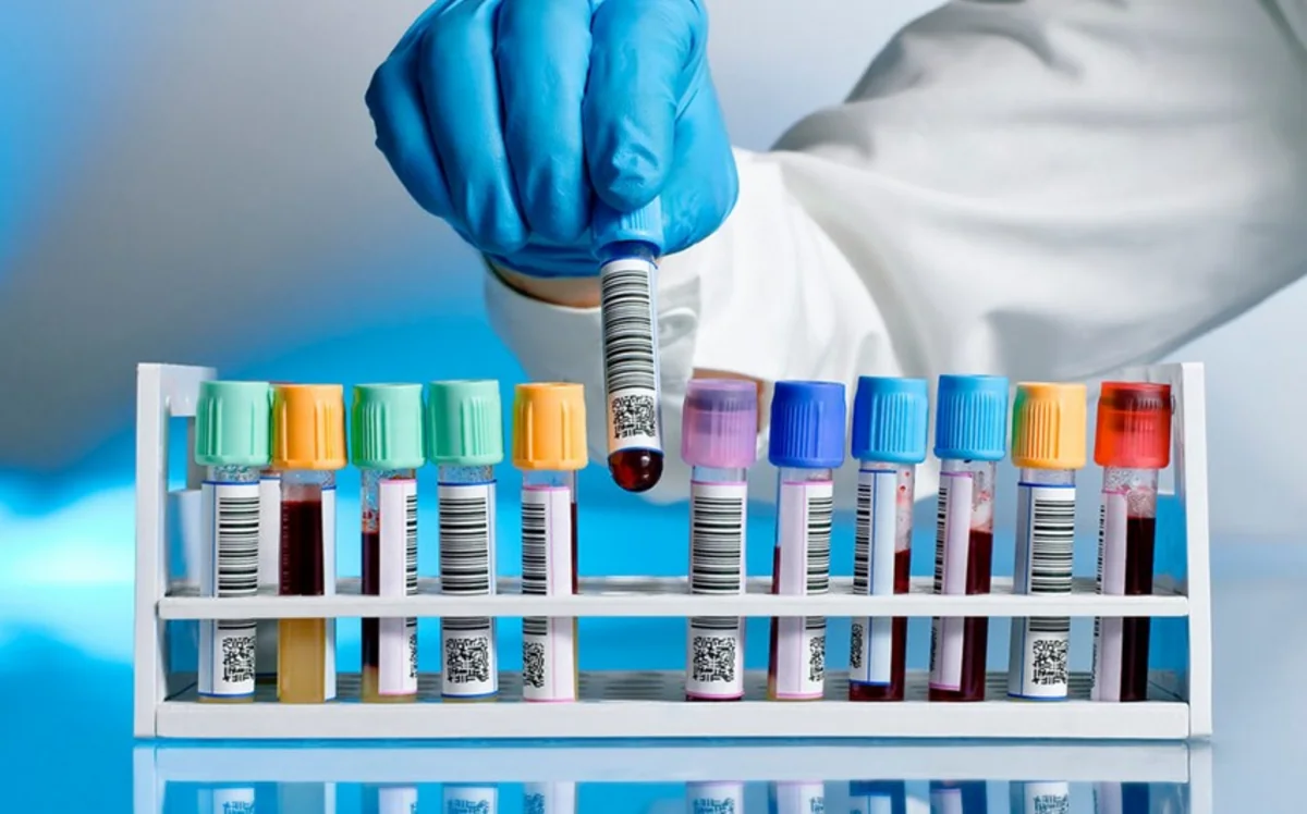 Азербайджанский боксер дисквалифицирован за допинг