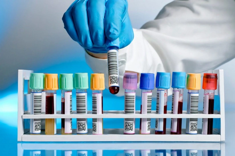 Азербайджанский боксер дисквалифицирован за допинг