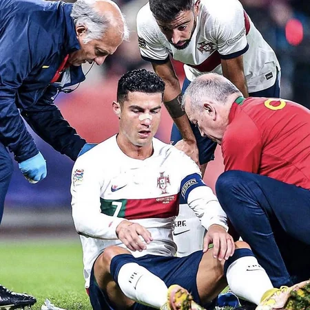 Ronaldu rəqib qapıçı ilə toqquşmadan sonra ciddi xəsarət alıb