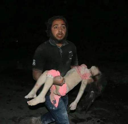 ​Rusiya qırıcıları Hələbin ən böyük xəstəxanasını bombalayıb, 53 dinc sakin həlak olub