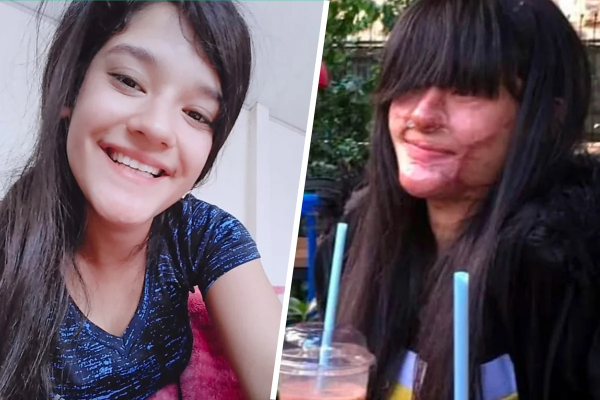 Turkish woman marries boyfriend who threw acid in her face