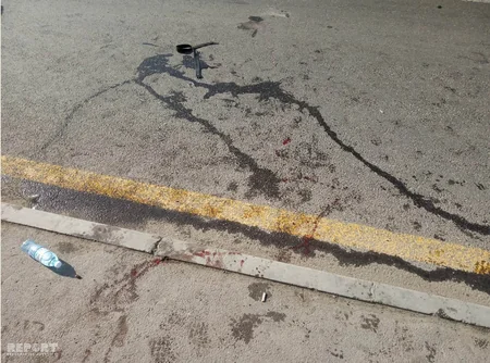 Bakıda sərnişin avtobusu yaşlı qadını vuraraq ağır xəsarət yetirib - FOTO