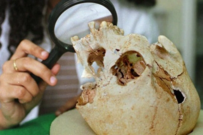 Braziliyada Cənubi Amerikanın ən qədim sakini sayılan qadının kəllə sümüyü tapılıb