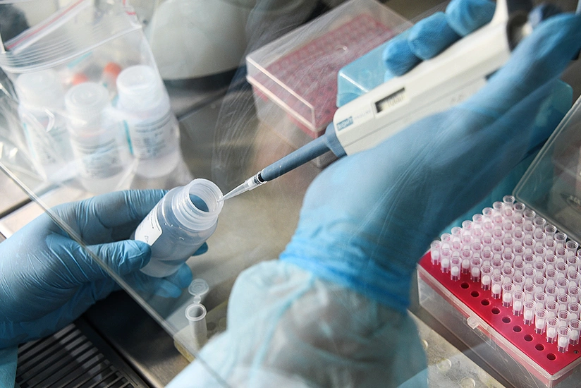 COVID-19: Azerbaijan confirms 528 new cases