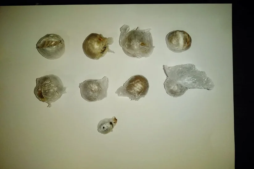 Azərbaycan gömrükçüləri ölkəyə daxili orqanında narkotik vasitə keçirmək istəyən şəxsi saxlayıblar