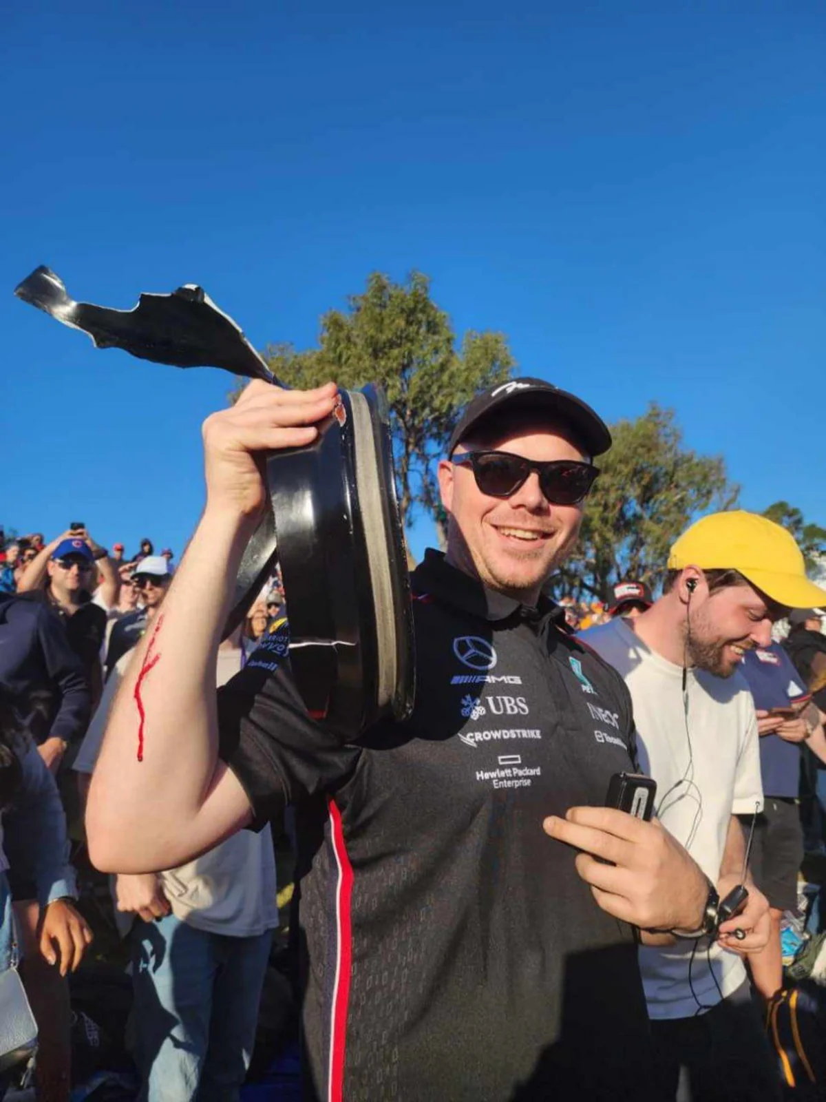 Formula 1: Avstraliya Qran Prisində azarkeş yaralanıb