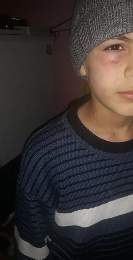 Dövlət Komitəsi anası tərəfindən döyüldüyü deyilən uşaqla bağlı araşdırmalara başlayıb