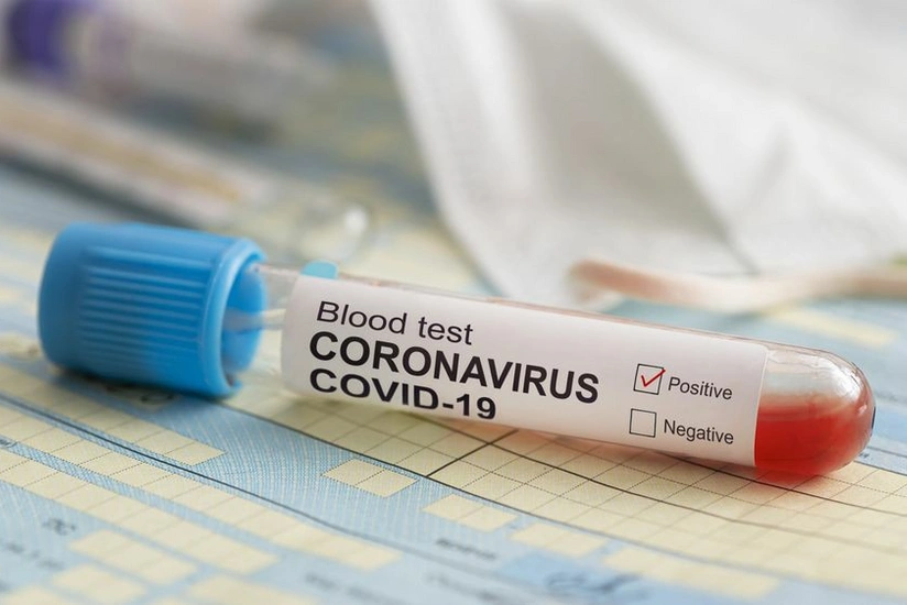 Azerbaijan confirms 1,402 new COVID-19 cases