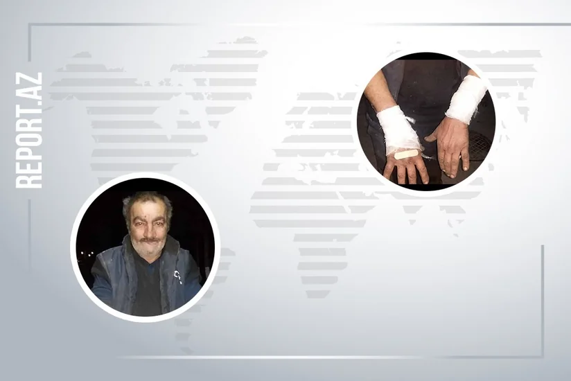 В Баку волк искусал 54-летнего мужчину - ФОТО - ВИДЕО
