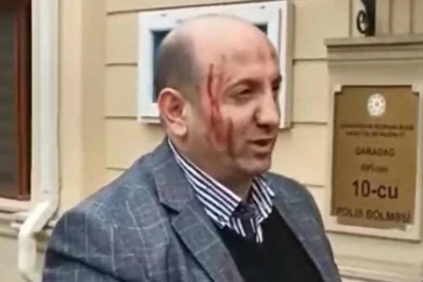 “Sədərək” Ticarət Mərkəzində axunda etiraz edən şəxs həbs olunub