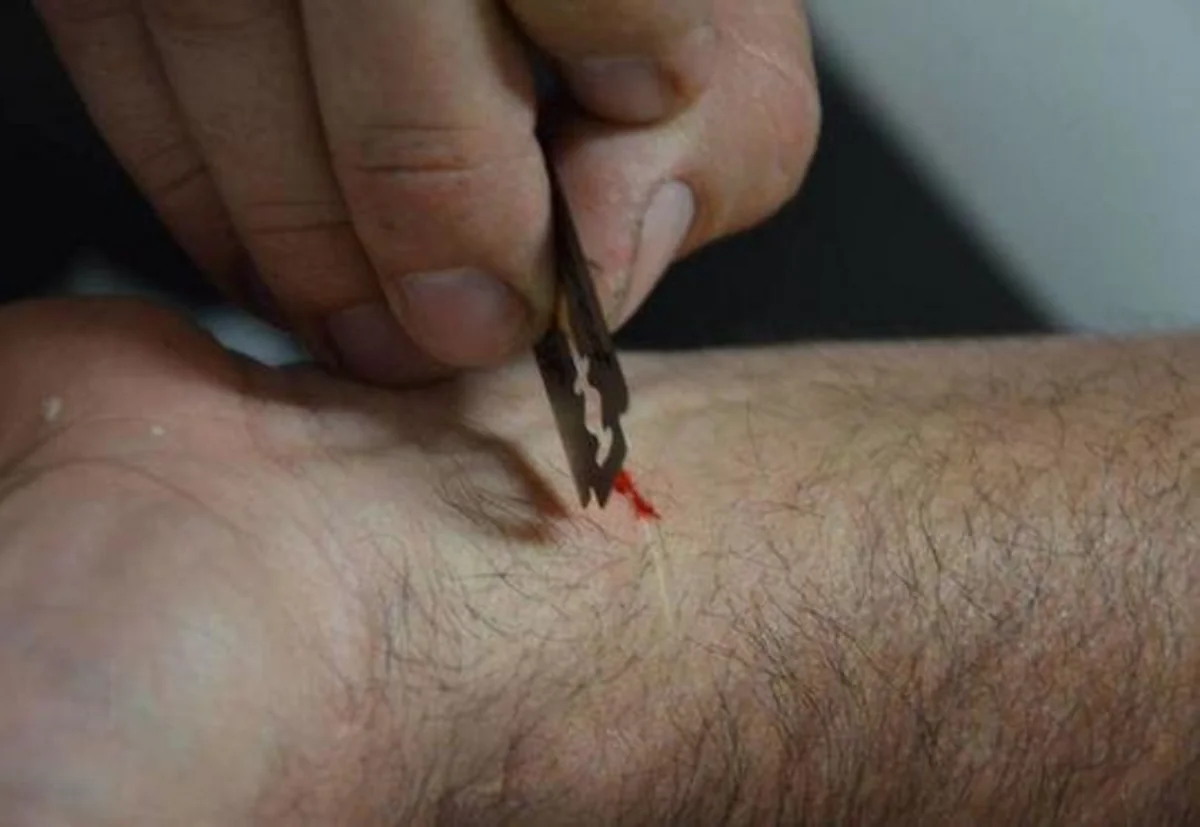 Cəlilabadda damarlarını doğrayan gənc Bakıya gətirildi