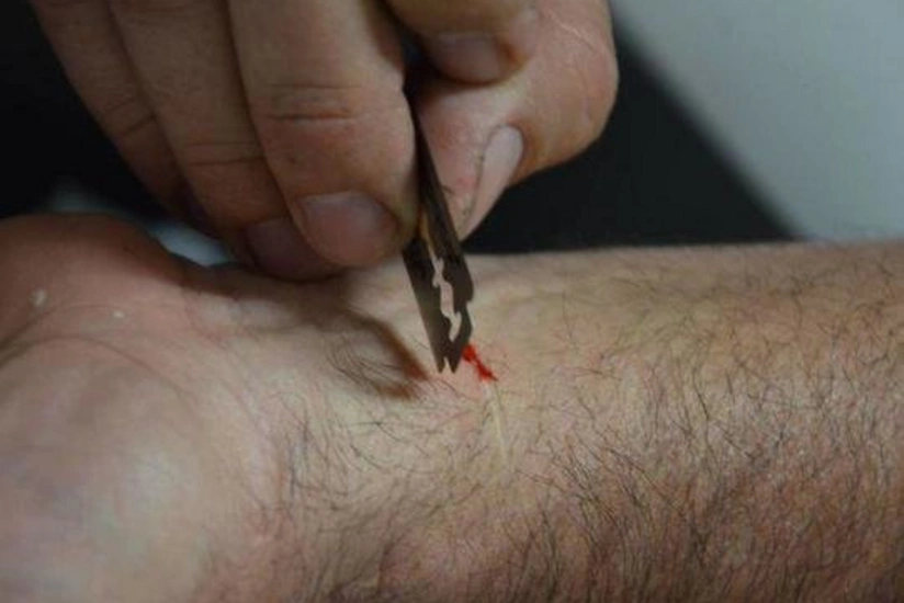 Cəlilabadda damarlarını doğrayan gənc Bakıya gətirildi