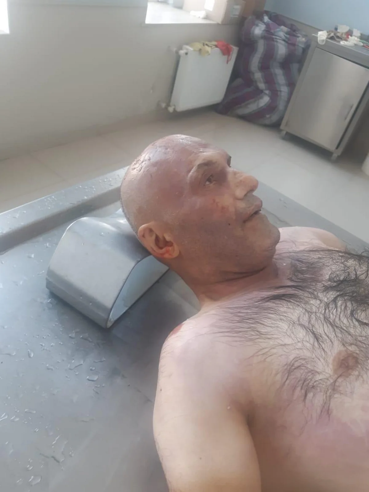 Bakıda avtomobillə vurularaq öldürülən naməlum kişi meyiti aşkarlanıb - FOTO
