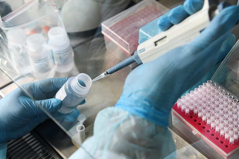 Azərbaycanda daha 647 yeni yoluxma faktı qeydə alınıb