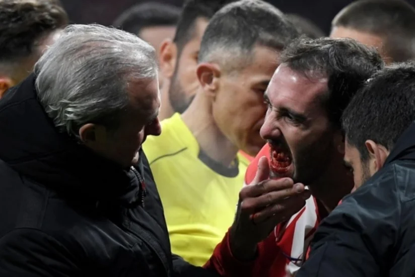 Atletikonun baş məşqçisi: Gərək, futbolçumuzu öldürsünlər ki, penalti verilsin