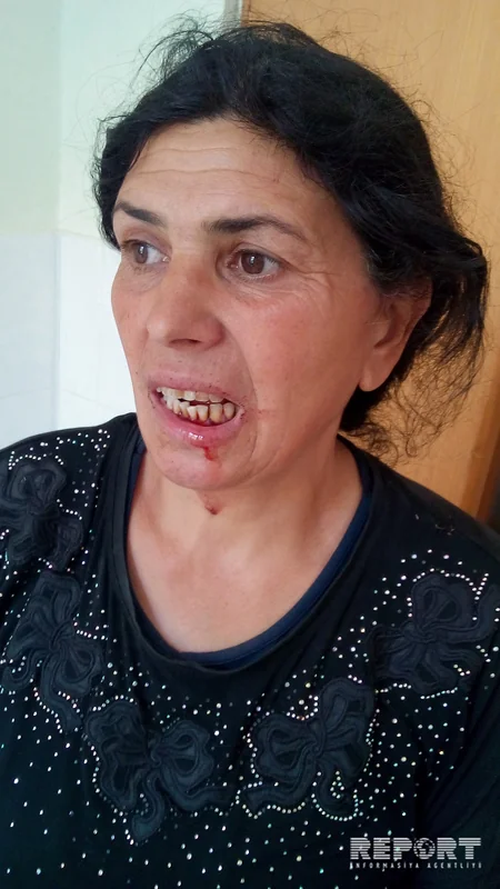 Şamaxıda kütləvi dava: Ər-arvad döyülüb - FOTO