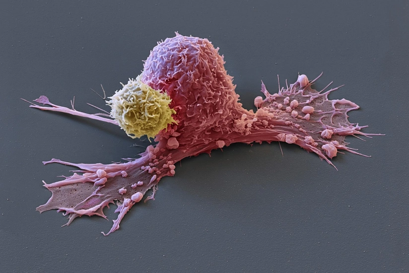 Oncologist reveals alarming symptoms of tongue cancer