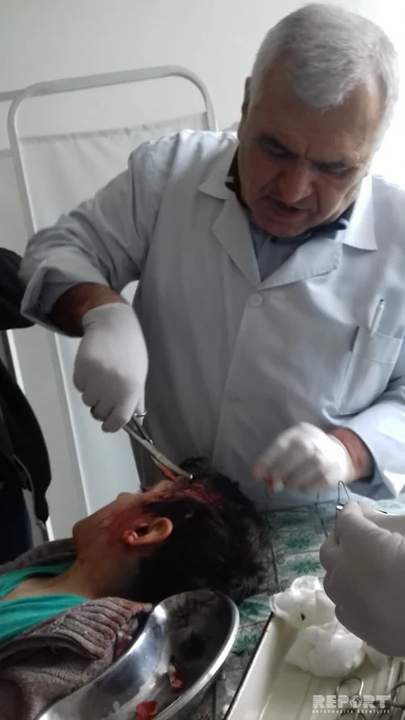В Астаре волки напали на школьников, пострадали 7 человек - ФOTO