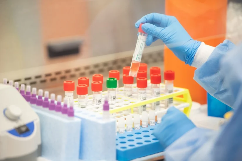 Azerbaijan runs over 53,000 coronavirus tests
