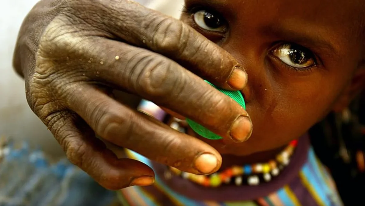 BMT: Sudanda on milyonlarla insan aclıqla mübarizə aparır